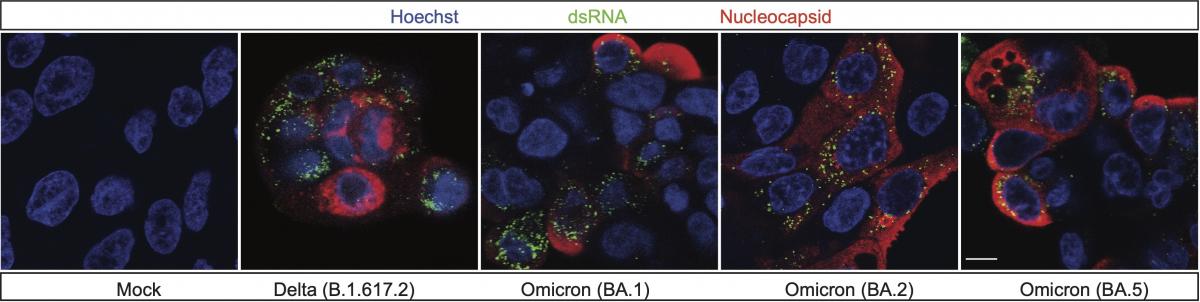 Figure: Human lung cells infected with COVID-19 variants. Credit: Pérez-Vargas, et al. 