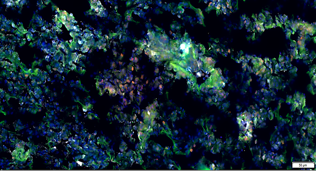 Multiplex Immunofluorescence technologies highlight ILC2s (orange) in mouse lungs.
