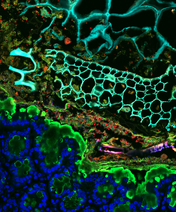 Figure of research from Tropini lab